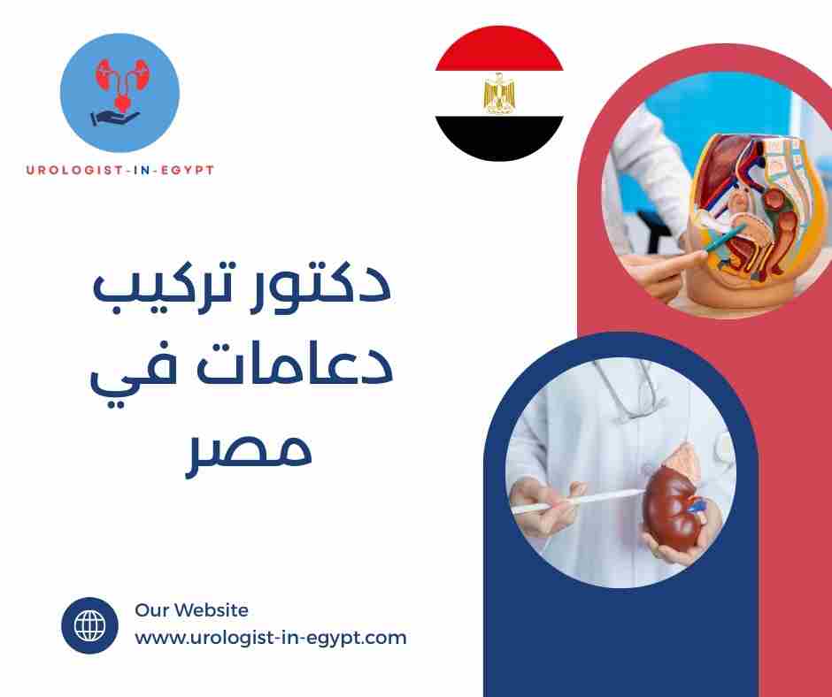 دكتور تركيب دعامات في مصر