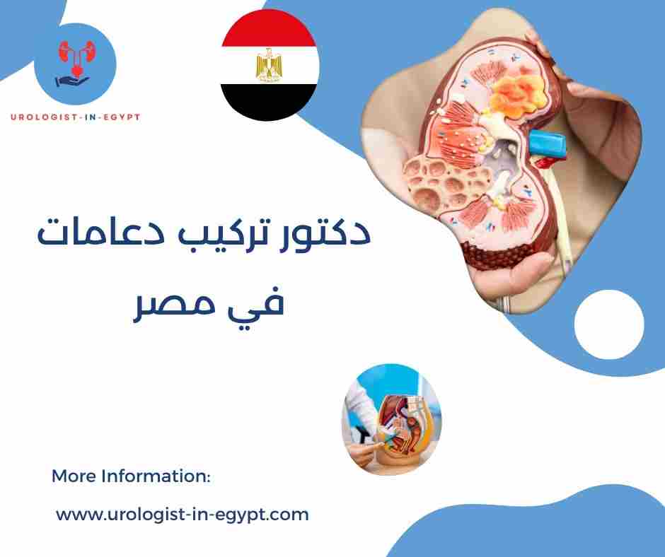 دكتور تركيب دعامات في مصر