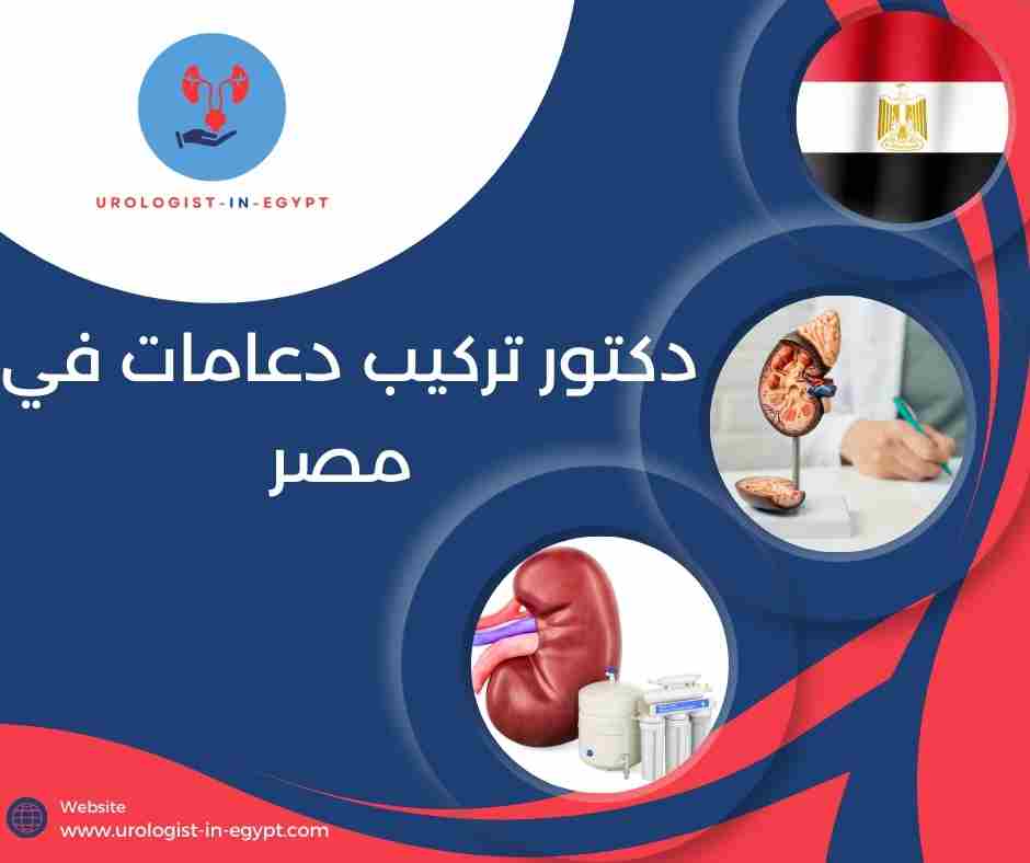 دكتور تركيب دعامات في مصر