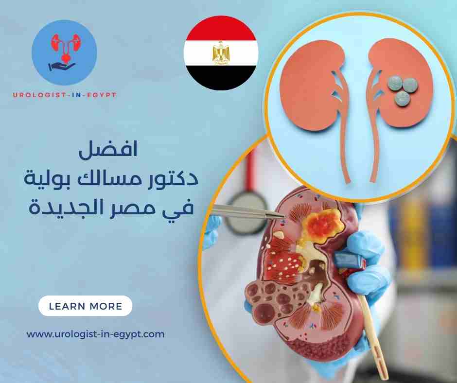 افضل دكتور مسالك بولية في مصر الأعلى تقييمًا افضل دكتور مسالك بولية في مصر الأعلى تقييمًا