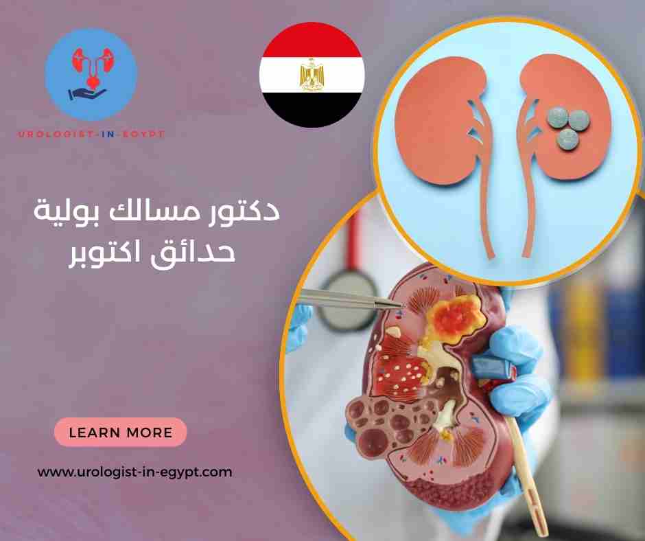 دكتور مسالك بولية حدائق اكتوبر