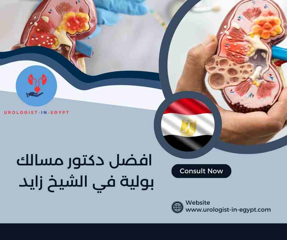افضل دكتور مسالك بولية في الشيخ زايد
