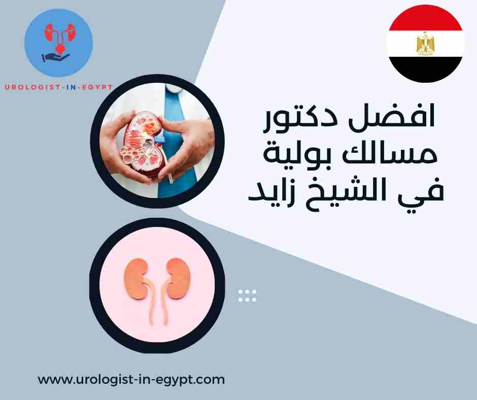 افضل دكتور مسالك بولية في الشيخ زايد