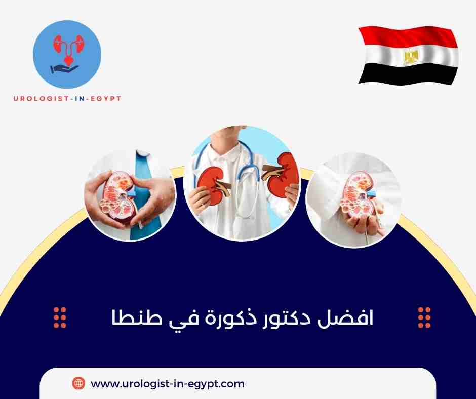 افضل دكتور ذكورة في طنطا
