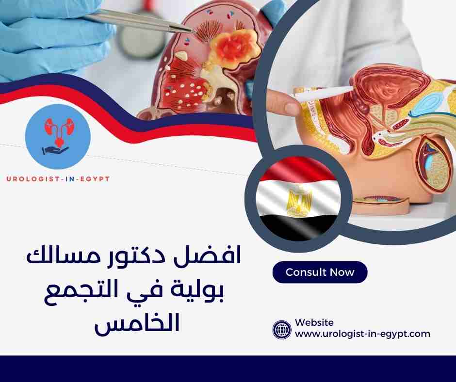 افضل دكتور مسالك بولية في القاهرة