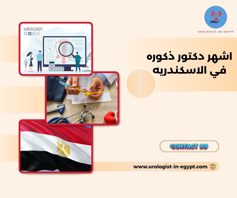 افضل دكتور ذكورة في اسكندريه