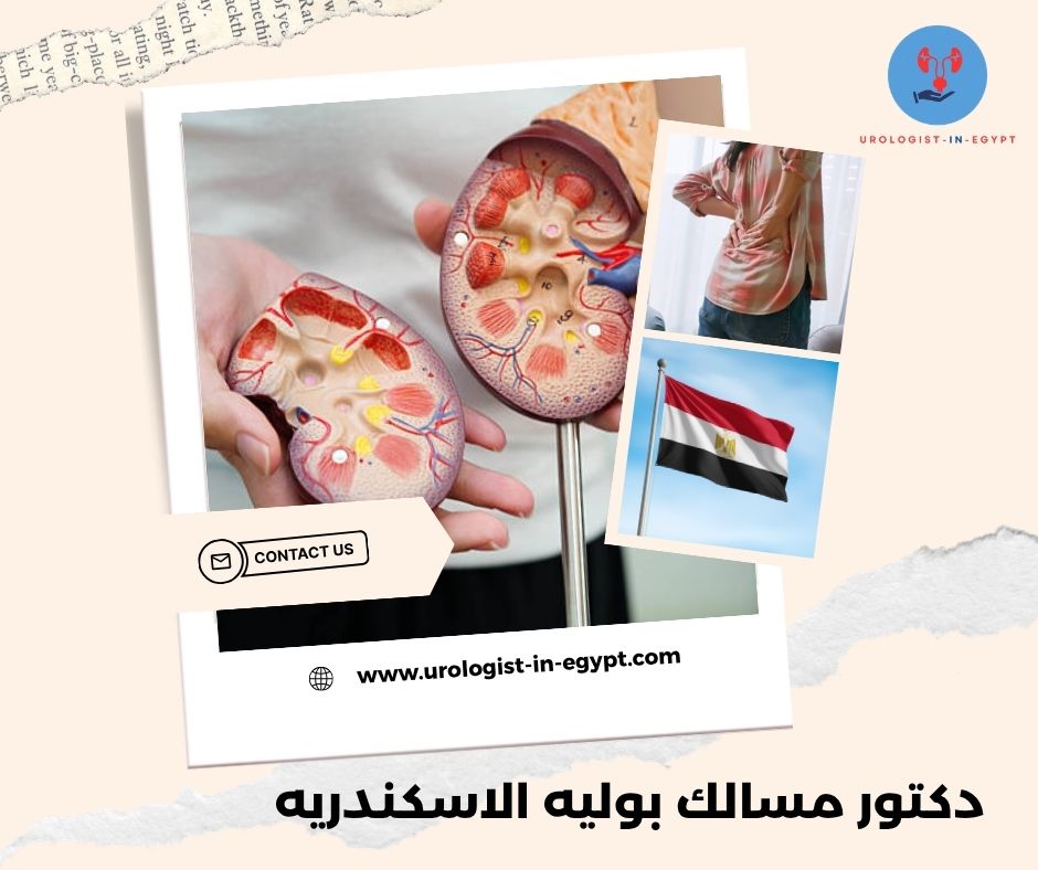 دكتور مسالك بوليه الاسكندريه دكتور مسالك بوليه الاسكندريه