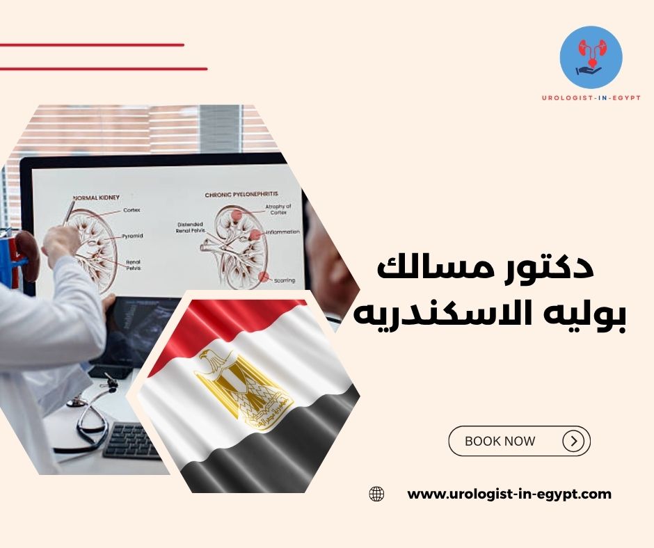 احسن دكتور مسالك بوليه الاسكندرية احسن دكتور مسالك بوليه الاسكندريةاحسن دكتور مسالك بوليه الاسكندرية