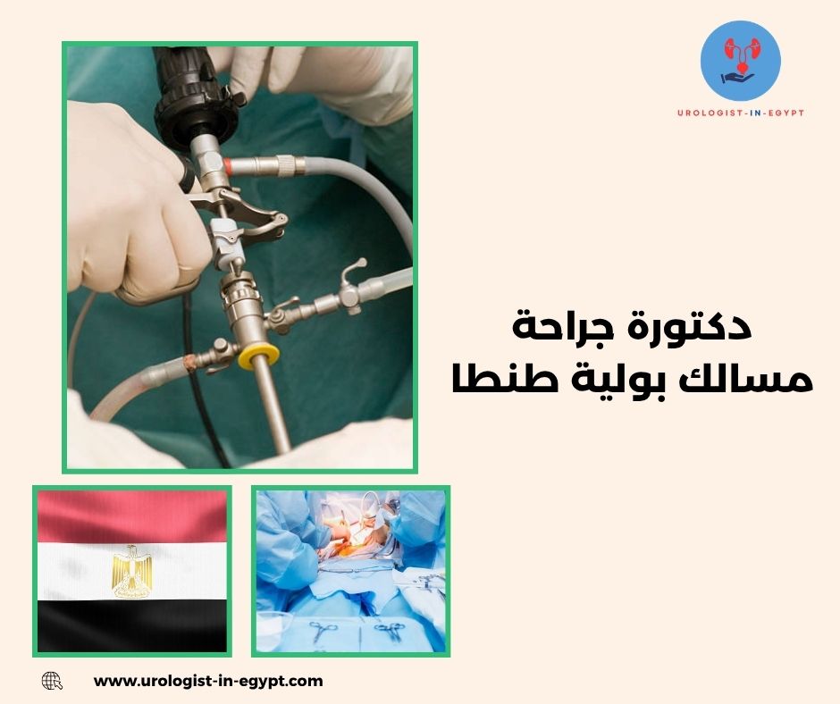 دكتورة جراحة مسالك بولية طنطا