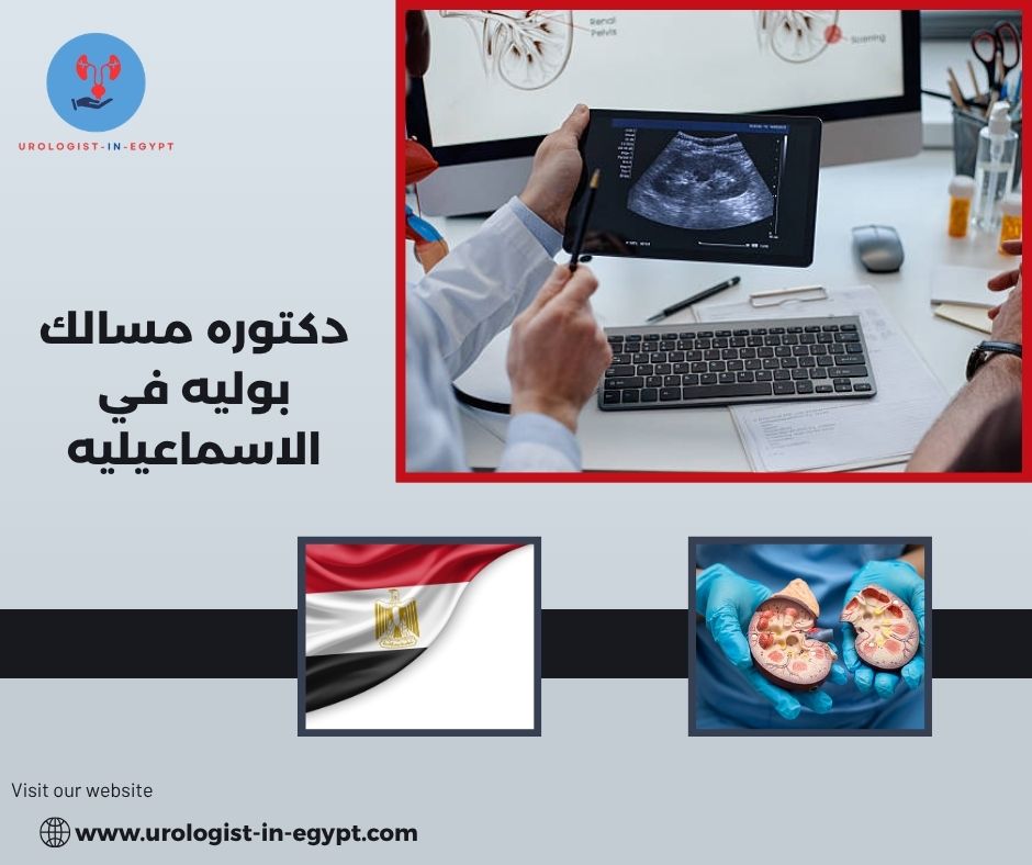 دكتوره مسالك بوليه بالاسماعيليه دكتوره مسالك بوليه بالاسماعيليه