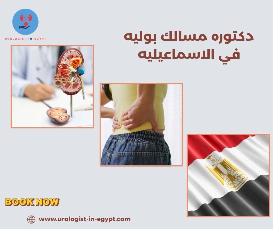 دكتوره مسالك بوليه في الاسماعيليه