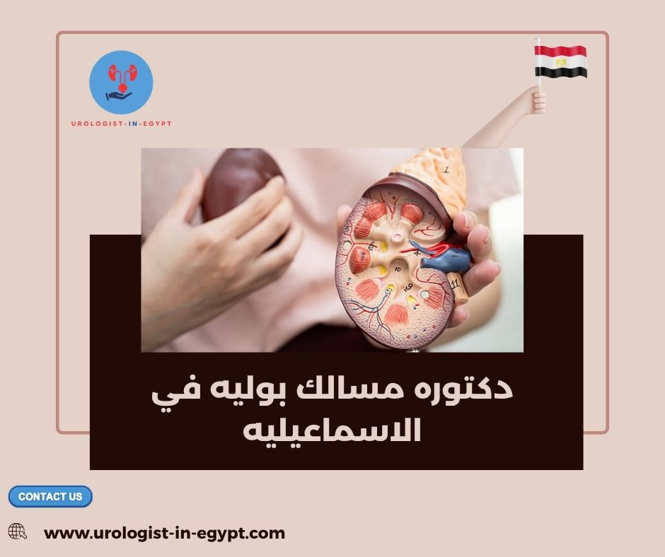 دكتوره مسالك بوليه في الاسماعيليه دكتوره مسالك بوليه في الاسماعيليه