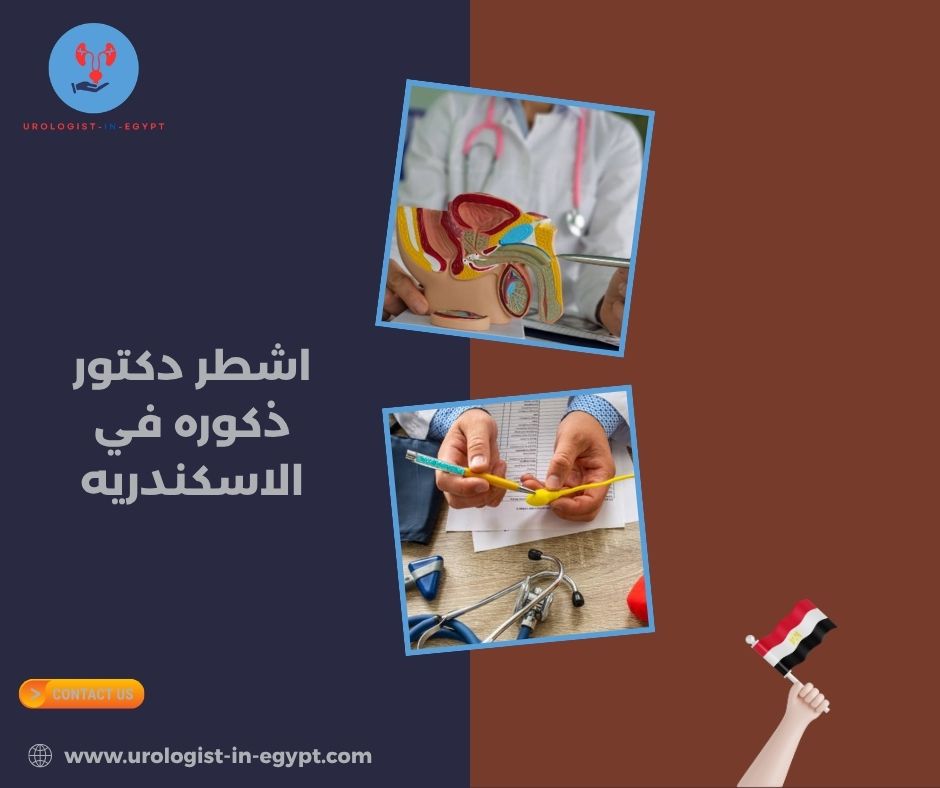 اشهر دكتور ذكوره في الاسكندريه اشهر دكتور ذكوره في الاسكندريه