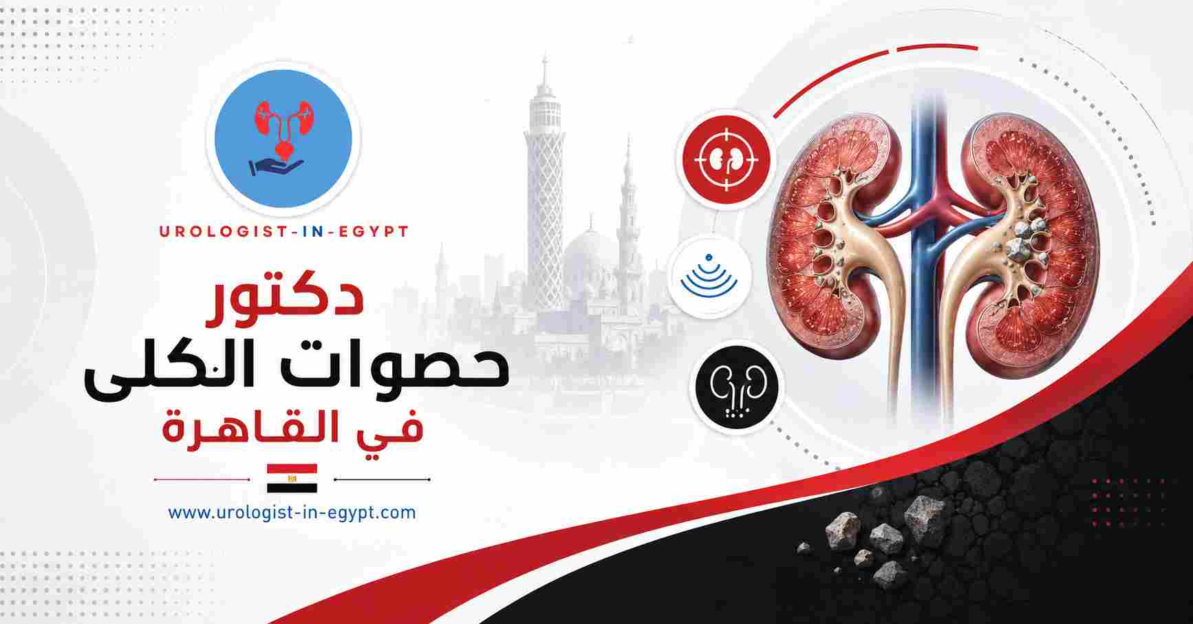 الوقاية من تكرار الحصوات